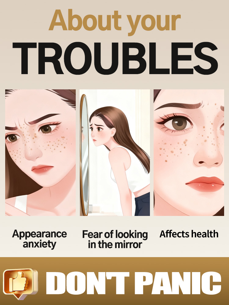 تفتيح النمش الوجه الكلف البقع  - مراجعة Luxury Natural Skincare وسعره